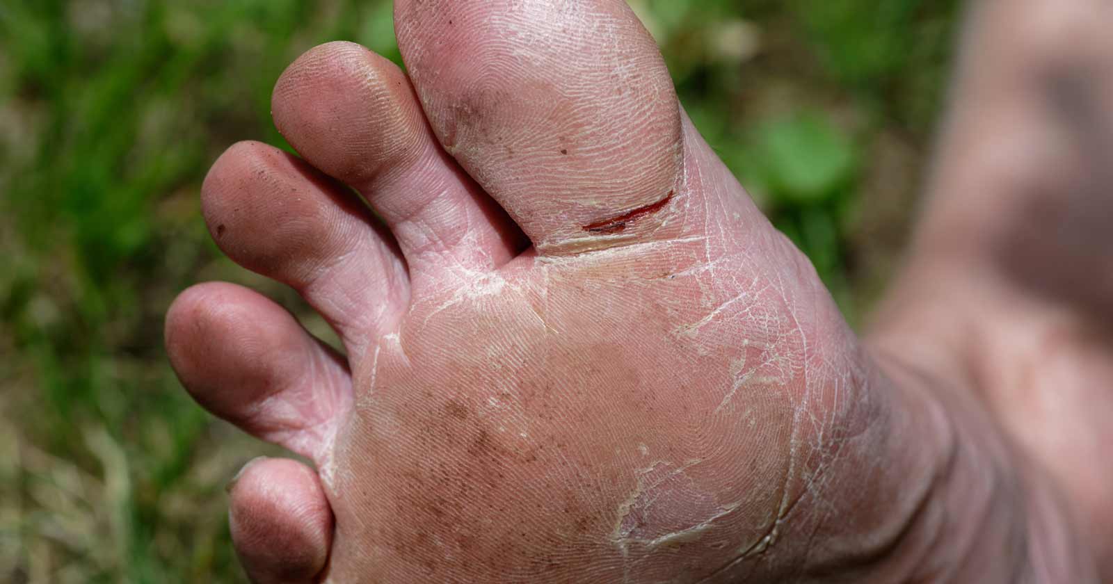 Wet feet, warm feet: Essential foot care for hikers The challenge of wet feet